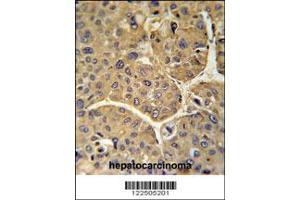 Immunohistochemistry (IHC) image for anti-Complement Factor H-Related 5 (CFHR5) antibody (ABIN2160058)