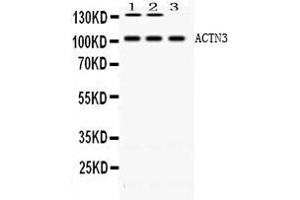 ACTN3 抗体  (C-Term)