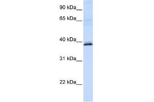 Image no. 1 for anti-Hydroxyacid Oxidase 2 (HAO2) (N-Term) antibody (ABIN2773784)