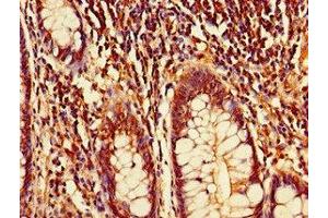 CDT2/RAMP antibody  (AA 393-550)