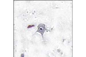 Image no. 1 for anti-Phosphoinositide 3 Kinase, p85 beta (PI3K p85b) (N-Term) antibody (ABIN360465)