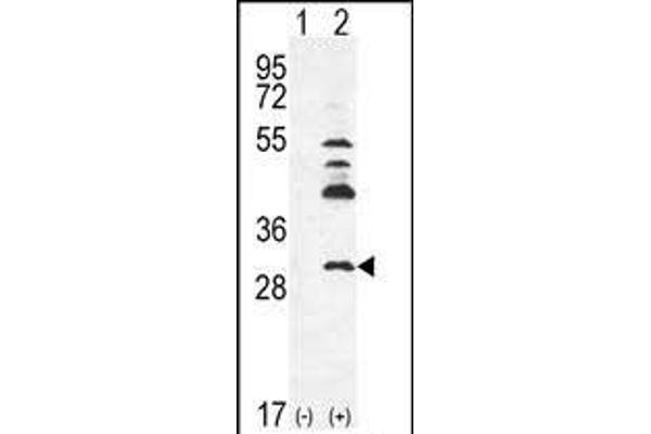 UCK2 antibody  (C-Term)