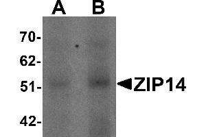 Image no. 2 for anti-Solute Carrier Family 39 (Zinc Transporter), Member 14 (SLC39A14) (Middle Region) antibody (ABIN1031178)