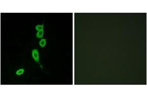 Image no. 2 for anti-Melanocortin 1 Receptor (MC1R) (AA 268-317) antibody (ABIN1535779)