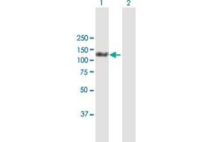 Image no. 1 for anti-MORC Family CW-Type Zinc Finger 3 (MORC3) (AA 1-939) antibody (ABIN525221)
