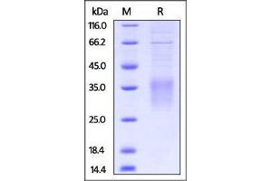 Image no. 2 for CD28 (CD28) (AA 20-149) protein (His tag) (ABIN2870719)