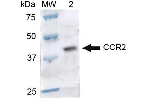 Image no. 1 for anti-Chemokine (C-C Motif) Receptor 2 (CCR2) antibody (ABIN5066695)