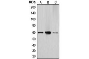 Image no. 3 for anti-Cytochrome P450, Family 27, Subfamily A, Polypeptide 1 (CYP27A1) (Center) antibody (ABIN2705982)
