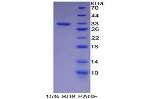 Image no. 1 for Cadherin-16 (CDH16) protein (ABIN3008546)