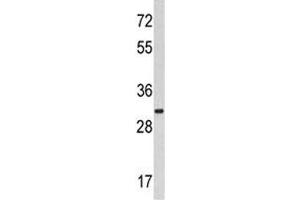 Image no. 1 for anti-Myristoylated Alanine-Rich Protein Kinase C Substrate (MARCKS) (AA 241-271) antibody (ABIN3031923)
