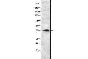 RASSF2 anticorps  (Internal Region)