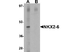 Western blot analysis of NKX2-6 in mouse spleen tissue lysate with NKX2-6 antibody at 1 µg/mL in (A) the absence and (B) the presence of blocking peptide.