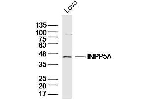 Image no. 1 for anti-Inositol Polyphosphate-5-Phosphatase, 40kDa (INPP5A) (AA 31-130) antibody (ABIN5675576)