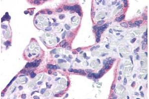 Image no. 2 for anti-Wilms Tumor 1 (WT1) (C-Term) antibody (ABIN604665)