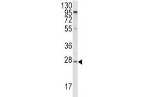 Image no. 2 for anti-Apolipoprotein A-I (APOA1) (AA 10-37) antibody (ABIN3029990)