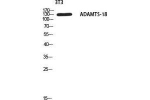 Image no. 2 for anti-ADAM Metallopeptidase with thrombospondin Type 1 Motif, 18 (ADAMTS18) antibody (ABIN3188077)