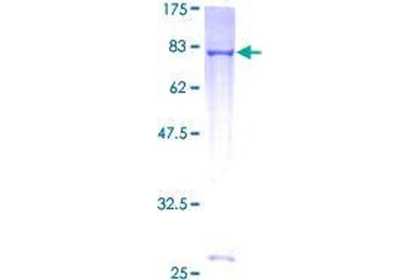 TRIM39 Protein (AA 1-488) (GST tag)