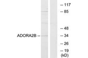 Image no. 1 for anti-Adenosine A2b Receptor (ADORA2B) (AA 231-280) antibody (ABIN1535642)