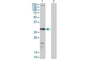 Image no. 1 for anti-Solute Carrier Family 39 (Zinc Transporter), Member 3 (SLC39A3) (AA 1-314) antibody (ABIN949250)