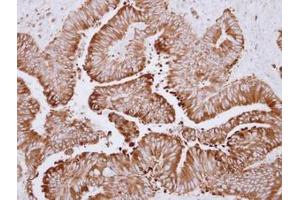 Image no. 1 for anti-Carboxylesterase 2 (CES2) (AA 310-522) antibody (ABIN1497478)
