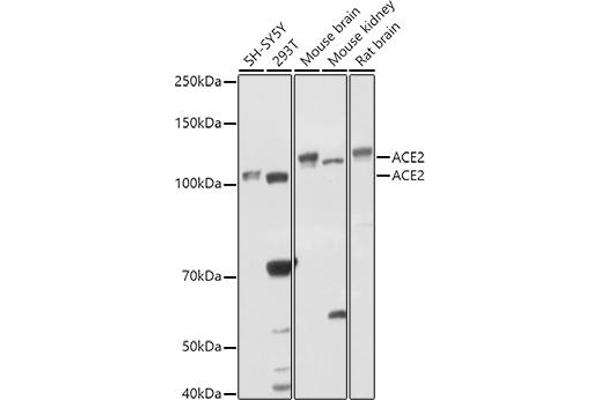 ACE2 antibody  (AA 18-250)