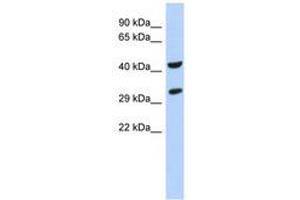 Image no. 1 for anti-Ankyrin Repeat and SOCS Box Containing 8 (ASB8) (N-Term) antibody (ABIN6741136)