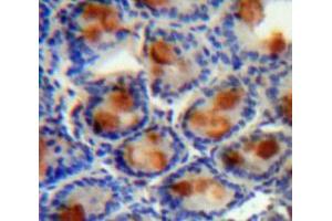 Image no. 2 for anti-Angiogenic Factor with G Patch and FHA Domains 1 (AGGF1) (AA 21-123) antibody (ABIN1171663)