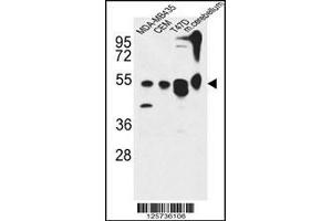 Image no. 1 for anti-Autophagy Related 13 (ATG13) (AA 1-30), (N-Term) antibody (ABIN653882)
