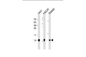 Image no. 1 for anti-S100 Calcium Binding Protein A2 (S100A2) antibody (ABIN4913830)