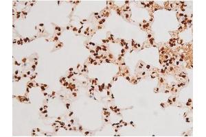 Image no. 15 for anti-REL proto-oncogene (c-Rel) (pSer503) antibody (ABIN6255382)