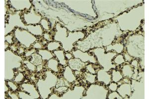 Image no. 3 for anti-Histone Deacetylase 5 (HDAC5) antibody (ABIN6262182)