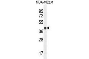 Image no. 1 for anti-Caspase 5, Apoptosis-Related Cysteine Peptidase (CASP5) antibody (ABIN2995932)