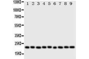 Image no. 1 for anti-Cytoglobin (CYGB) (AA 50-68), (N-Term) antibody (ABIN3043127)