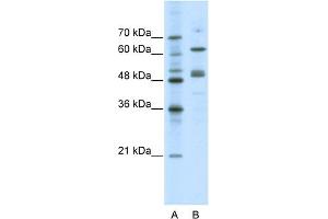 Image no. 1 for anti-GATA Binding Protein 4 (GATA4) (N-Term) antibody (ABIN2780394)