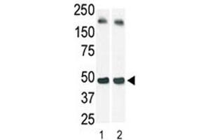 Image no. 4 for anti-Sphingosine Kinase 1 (SPHK1) (AA 1-30) antibody (ABIN3032709)