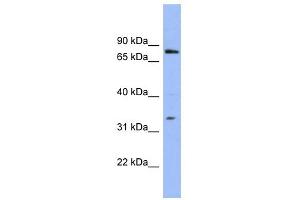 Image no. 1 for anti-Zinc Finger Protein 278 (ZNF278) (N-Term) antibody (ABIN2779693)