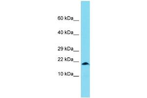 anti-X Antigen Family, Member 1B (XAGE1B) (Middle Region) antibody