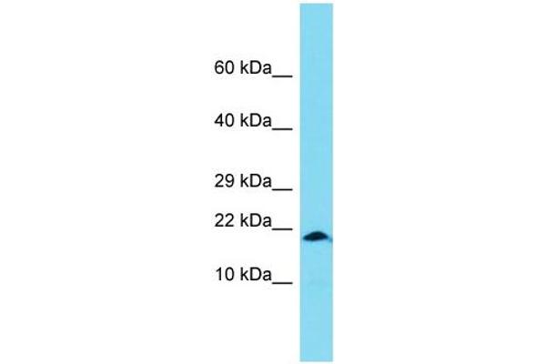 anti-X Antigen Family, Member 1B (XAGE1B) (Middle Region) antibody