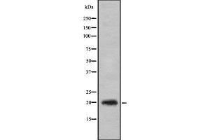 Image no. 1 for anti-CD3g Molecule, gamma (CD3-TCR Complex) (CD3G) (Internal Region) antibody (ABIN6260620)