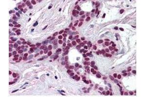 Anti-CUL3 antibody was diluted 1:500 to detect CUL3 in human breast tissue.