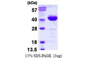 Image no. 1 for Phosducin-Like (PDCL) protein (His tag) (ABIN6386983)