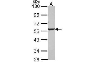 Image no. 2 for anti-DKK3 (Center) antibody (ABIN2854796)
