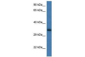 Image no. 1 for anti-Glucosamine-6-Phosphate Deaminase 1 (GNPDA1) (N-Term) antibody (ABIN2783313)