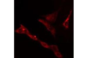Image no. 1 for anti-Kelch-Like 3 (KLHL3) antibody (ABIN6262847)