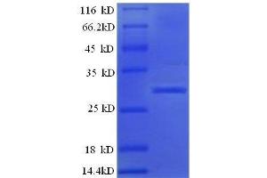 Islet Amyloid Polypeptide (IAPP) (AA 34-70), (full length) protein (GST tag)