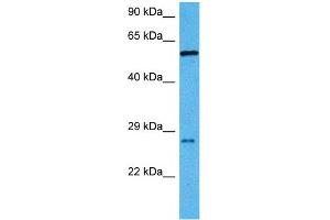 Image no. 3 for anti-Recombination Signal Binding Protein For Immunoglobulin kappa J Region (RBPJ) (C-Term) antibody (ABIN2777213)