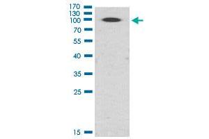 Image no. 1 for anti-Protein Kinase D2 (PKD2) (pSer876) antibody (ABIN5774316)