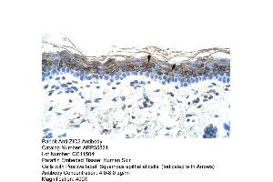 Image no. 3 for anti-ZIC2 (ZIC2) (C-Term) antibody (ABIN2776475)