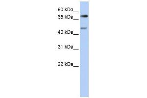 Image no. 1 for anti-Denticleless E3 Ubiquitin Protein Ligase Homolog (DTL) antibody (ABIN630978)