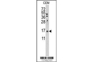 Image no. 1 for anti-LSM1 Homolog, U6 Small Nuclear RNA Associated (LSM1) (AA 103-133), (C-Term) antibody (ABIN389386)